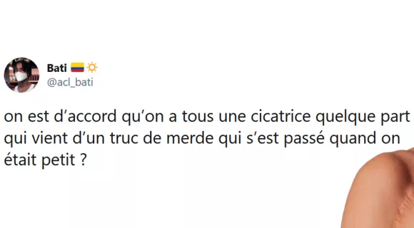 Image de couverture de l'article : Les 15 meilleurs tweets sur des histoires de cicatrice, des souvenirs à vie