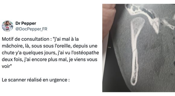 Image de couverture de l'article : L’ostéopathie est-elle une pratique dangereuse pour la santé ?