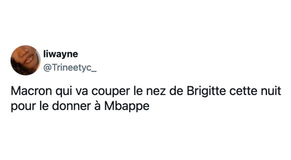 Image de couverture de l'article : Le nez cassé de Mbappé