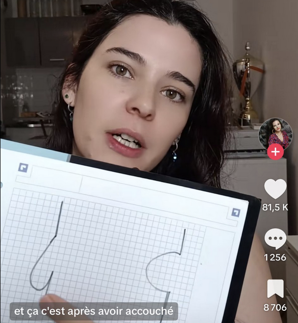 Femme montrant sur un dessin l'avant et l'apr&egrave;s de sa grossesse sur son fessier